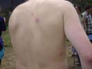 Blessure Cyrille 2